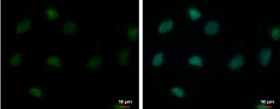 Immunocytochemistry/Immunofluorescence: USP26 Antibody [NBP2-20830] - USP26 antibody [C2C3], C-term detects USP26 protein at nucleus by immunofluorescent analysis. Sample: NT2D1 cells were fixed in 4% paraformaldehyde at RT for 15 min.Green: USP26 protein stained by USP26 antibody [C2C3], C-term  diluted at 1:500.Blue: Hoechst 33342 staining.