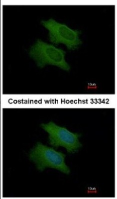 Immunocytochemistry/Immunofluorescence: CFHL1 Antibody [NBP2-15868] - Immunofluorescence analysis of methanol-fixed HeLa, using antibody at 1:200 dilution.