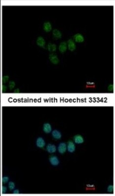 Immunocytochemistry/Immunofluorescence: HDAC7 Antibody [NBP2-16794] - Immunofluorescence analysis of paraformaldehyde-fixed HCT116, using antibody at 1:500 dilution.