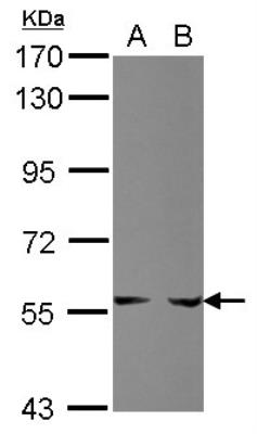 Western Blot: Phosphoribosyl Pyrophosphate Amidotransferase Antibody [NBP2-19812] -  A: HepG2 B: HCT116.