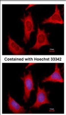 Immunocytochemistry: Phosphoribosyl Pyrophosphate Amidotransferase Antibody [NBP2-19812] - Immunofluorescence analysis of methanol-fixed HeLa, using antibody at 1:500 dilution.