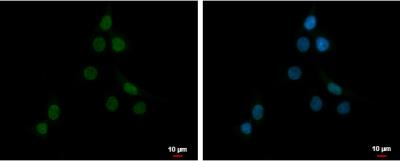 Immunocytochemistry/Immunofluorescence: PLAG1 Antibody [NBP2-15074] - U87-MG cells were fixed in 4% paraformaldehyde at RT for 15 min. Green: PLAG1 protein stained by PLAG1 antibody  diluted at 1:500. Blue: Hoechst 33342 staining. Scale bar = 10 um.