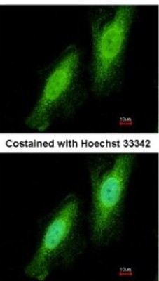 Immunocytochemistry/Immunofluorescence: TRIM41 Antibody [NBP2-20717] - Analysis of paraformaldehyde-fixed HeLa, using antibody at 1:200 dilution.