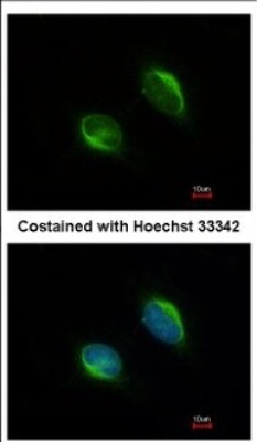 Immunocytochemistry/Immunofluorescence: TYW1 Antibody [NBP2-20772] - Immunofluorescence analysis of methanol-fixed HeLa, using antibody at 1:200 dilution.