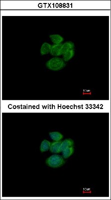 Immunocytochemistry/Immunofluorescence: Rap2A Antibody [NBP2-20074] - Immunofluorescence analysis of methanol-fixed MCF-7, using antibody at 1:500 dilution.