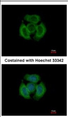 Immunocytochemistry/Immunofluorescence: Tropomodulin 3 Antibody [NBP2-20731] - Immunofluorescence analysis of methanol-fixed MCF-7, using antibody at 1:500 dilution.