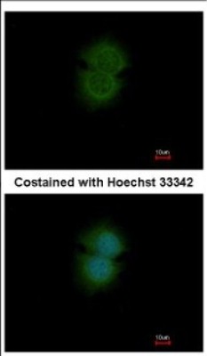 Immunocytochemistry/Immunofluorescence: TBL2 Antibody [NBP2-20579] - Immunofluorescence analysis of methanol-fixed MCF-7, using antibody at 1:200 dilution.