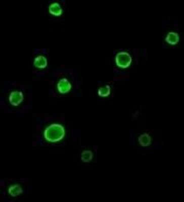 Immunocytochemistry/Immunofluorescence: Bax Antibody [NBP1-77151] - HL60 cells with Bax antibody at 2 ug/mL.