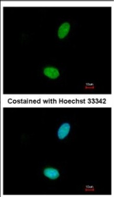 Immunocytochemistry/Immunofluorescence: ZNF408 Antibody [NBP2-21007] - Immunofluorescence analysis of paraformaldehyde-fixed A549, using antibody at 1:500 dilution.
