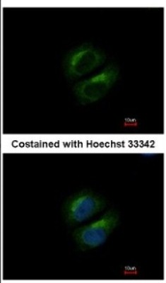 Immunocytochemistry/Immunofluorescence: PCBP3 Antibody [NBP2-19716] - Immunofluorescence analysis of methanol-fixed MCF-7, using antibody at 1:500 dilution.