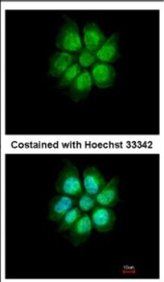 Immunocytochemistry/Immunofluorescence: MEFV Antibody [NBP2-17262] - Immunofluorescence analysis of paraformaldehyde-fixed A431, using antibody at 1:500 dilution.