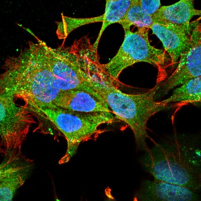 Immunocytochemistry/Immunofluorescence: Notch-1 Antibody (S253-32) [NBP2-22406] - Tissue: Neuroblastoma cell line SK-N-BE. Species: Human. Fixation: 4% Formaldehyde for 15 min at RT. Primary Antibody: Mouse Anti-Notch1 Monoclonal Antibody at 1:100 for 60 min at RT. Secondary Antibody: Goat Anti-Mouse ATTO 488 at 1:100 for 60 min at RT. Counterstain: Phalloidin Texas Red F-Actin stain; DAPI (blue) nuclear stain at 1:1000, 1:5000 for 60min RT, 5min RT. Localization: Cell Membrane, Nucleus. Magnification: 60X.