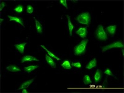 Immunocytochemistry/Immunofluorescence: CPVL Antibody (2G5-1C1) [H00054504-M01] - Analysis of monoclonal antibody to CPVL on HeLa cell. Antibody concentration 10 ug/ml.