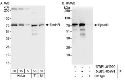 Western Blot: Clathrin interactor 1 Antibody [NBP1-05991] - Whole cell  lysate from HeLa, 293T, and mouse NIH3T3 cells. EpsinR was also  immunoprecipitated by rabbit anti-EpsinR antibody NBP1-05990.