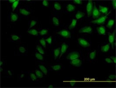Immunocytochemistry/Immunofluorescence: Kaptin Antibody (1C7) [H00011133-M01] - Analysis of monoclonal antibody to KPTN on HeLa cell. Antibody concentration 10 ug/ml.