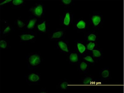 Immunocytochemistry/Immunofluorescence: RAP1GDS1 Antibody [H00005910-B01P] - Analysis of purified antibody to RAP1GDS1 on HeLa cell. (antibody concentration 10 ug/ml)