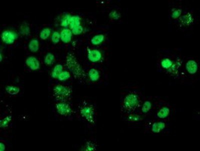 Immunocytochemistry/Immunofluorescence: SAT1 Antibody (2E6) [NBP2-01331] Staining of COS7 cells transiently transfected by pCMV6-ENTRY SAT1.