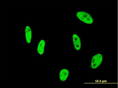Immunocytochemistry/Immunofluorescence: NUDT21 Antibody (3F8) [H00011051-M12] - Analysis of monoclonal antibody to NUDT21 on HeLa cell. Antibody concentration 10 ug/ml