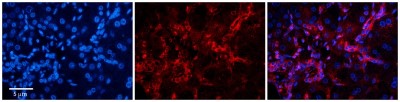 Immunocytochemistry/Immunofluorescence: RPE Antibody [NBP1-56853] - Antibody  0 Formalin Fixed Paraffin Embedded Tissue: Human Adult Liver  Observed Staining: Cytoplasm but only in connective tissue cells in the interlobular septum, very low tissue distribution Primary Antibody