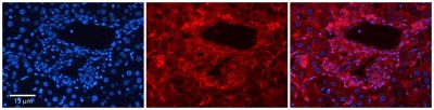 Immunocytochemistry/Immunofluorescence: SLC26A1 Antibody [NBP1-59652] - Formalin Fixed Paraffin; Embedded Tissue: Human Adult Liver; Observed Staining: Membrane in hepatocytes; Membrane and Cytoplasm in cells of the portal vein, hepatic arteries and bile ducts, strong signal, wide tissue distribution; Primary Antibody Concentration: 1:100