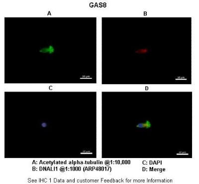 Immunocytochemistry/Immunofluorescence: GAS8 Antibody [NBP1-55508] - Application: IHCSpecies+tissue/cell type: Species+tissue/cell type: Human nasal epithelial cells Primary Antibody dilution: 1 : 1200 Secondary Antibody: Goat anti-rabbit Alexa Fluor 546 Secondary Antibody dilution: 1 : 1000 - See more at:  //www. avi
