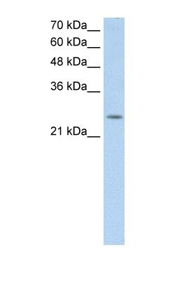 Western Blot: C5orf4 Antibody [NBP1-60125] - HepG2 cell lysate, Antibody Titration: 0.2-1 ug/ml