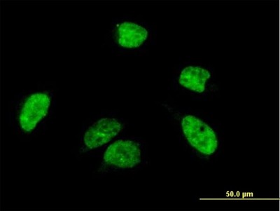 Immunocytochemistry/Immunofluorescence: ACF Antibody [H00029974-B01P] - Analysis of purified antibody to A1CF on HeLa cell. (antibody concentration 10 ug/ml)