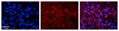 Immunocytochemistry/Immunofluorescence: Dnd1 Antibody [NBP1-57258] - Formalin Fixed Paraffin; Embedded Tissue: Human Pineal Tissue; Observed Staining: Cytoplasmic in pinealocytes; Primary Antibody Concentration: 1:100