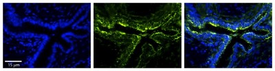 Immunocytochemistry/Immunofluorescence: Lysine Hydroxylase 2/PLOD2 Antibody [NBP1-58004] - Formalin Fixed Paraffin; Embedded Tissue: Human Bronchial Epithelial Tissue; Observed Staining: Cytoplasmic; Primary Antibody Concentration: 1:100