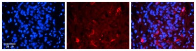 Immunocytochemistry/Immunofluorescence: FBX09 Antibody [NBP1-55054] - Formalin Fixed Paraffin; Embedded Tissue: Human Pineal Tissue; Observed Staining: Cytoplasmic in cell bodies and processes of pinealocytes; Primary Antibody Concentration: 1:100
