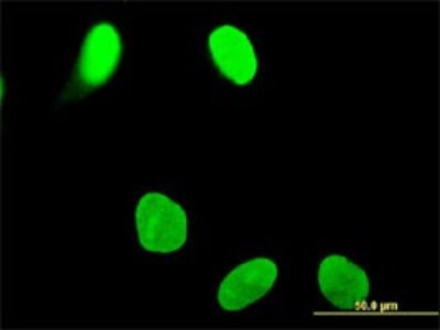 Immunocytochemistry/Immunofluorescence: OTUD7B/Cezanne/ZA20D1 Antibody (2B4) [H00056957-M01] - Analysis of monoclonal antibody to OTUD7B on HeLa cell. Antibody concentration 10 ug/ml.