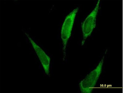 Immunocytochemistry/Immunofluorescence: FARSLA Antibody [H00002193-B01P] - Analysis of purified antibody to FARSLA on HeLa cell. (antibody concentration 10 ug/ml)