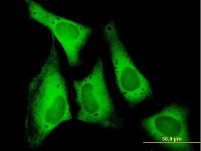 Immunocytochemistry/Immunofluorescence: Eukaryotic translation initiation factor 5B Antibody [H00009669-B01P] - Analysis of purified antibody to EIF5B on HeLa cell. (antibody concentration 10 ug/ml)