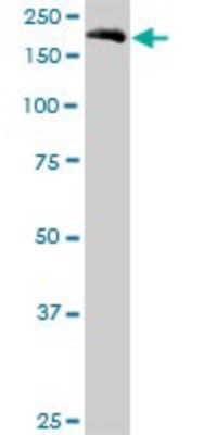 Western Blot: Eukaryotic translation initiation factor 5B Antibody [H00009669-B01P] - Analysis of EIF5B expression in Jurkat.