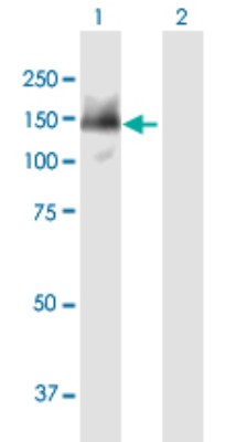 Western Blot: SMARCAD1 Antibody [H00056916-B01P] - Analysis of SMARCAD1 expression in transfected 293T cell line by SMARCAD1 polyclonal antibody.  Lane 1: SMARCAD1 transfected lysate(113.08 KDa). Lane 2: Non-transfected lysate.