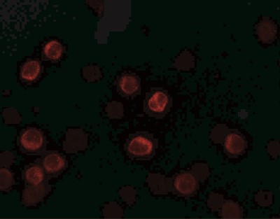 Immunocytochemistry/Immunofluorescence: IL-28B/IFN-lambda 3 Antibody [NBP2-41236] - Immunofluorescence of IL-28B in HeLa cells with IL-28B antibody at 5 ug/mL.
