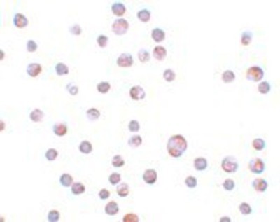 Immunocytochemistry/Immunofluorescence: ZC3HAV1L Antibody [NBP1-77184] - HeLa cells with ZC3HAV1 antibody at 20 ug/mL.
