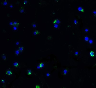 Immunofluorescence: JMJD2B Antibody [NBP1-76314] - JMJD2B in A-20 cells with JMJD2B antibody at 20 ug/ml.