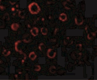 Immunocytochemistry/Immunofluorescence: MADD Antibody [NBP1-77033] - Immunofluorescence of MADD in Hela cells with MADD antibody at 20 ug/mL.
