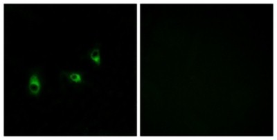 Immunocytochemistry/Immunofluorescence: OR10G2 Antibody [NBP1-71130] - Analysis of MCF7 cells, using OR10G2 Antibody. The picture on the right is treated with the synthesized peptide.