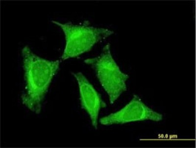 Immunocytochemistry/Immunofluorescence: RASGEF1C Antibody (3H8) [H00255426-M01] - Analysis of monoclonal antibody to RASGEF1C on HeLa cell. Antibody concentration 10 ug/ml.