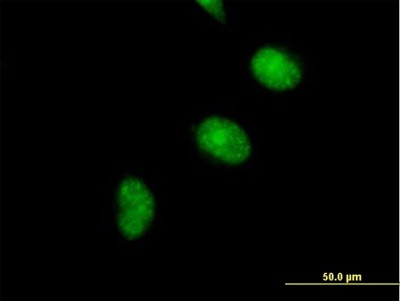 Immunocytochemistry/Immunofluorescence: CDCA5 Antibody [H00113130-B01P] - Analysis of purified antibody to CDCA5 on HeLa cell. (antibody concentration 10 ug/ml)