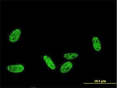 Immunocytochemistry/Immunofluorescence: PRKRIP1 Antibody (1F6-3C2) [H00079706-M01] - Analysis of monoclonal antibody to PRKRIP1 on HeLa cell. Antibody concentration 10 ug/ml.