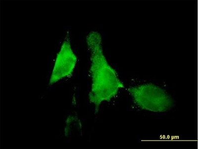 Immunocytochemistry/Immunofluorescence: 12-Lipoxygenase Antibody [H00000239-B01P] - Analysis of purified antibody to ALOX12 on HeLa cell. (antibody concentration 10 ug/ml)