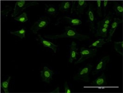 Immunocytochemistry/Immunofluorescence: PQBP1 Antibody (3H7) [H00010084-M15] - Analysis of monoclonal antibody to PQBP1 on HeLa cell. Antibody concentration 10 ug/ml