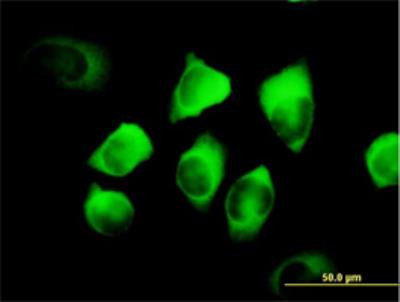 Immunofluorescence: NAP1L1 Antibody [H00004673-B02P] - of purified MaxPab antibody to NAP1L1 on HeLa cell. [antibody concentration 10 ug/ml]