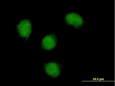 Immunocytochemistry/Immunofluorescence: Nova1 Antibody [H00004857-B01P] - Analysis of purified antibody to NOVA1 on HeLa cell. (antibody concentration 10 ug/ml)