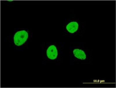 Immunocytochemistry/Immunofluorescence: NOL4 Antibody (2A10) [H00008715-M01] - Analysis of monoclonal antibody to NOL4 on HeLa cell. Antibody concentration 10 ug/ml.