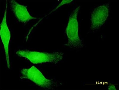 Immunocytochemistry/Immunofluorescence: NGFRAP1/BEX3/NADE Antibody [H00027018-B01P] - Analysis of purified antibody to NGFRAP1 on HeLa cell. (antibody concentration 10 ug/ml)
