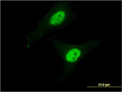 Immunocytochemistry/Immunofluorescence: Calpain 3 Antibody (1B2) [H00000825-M01] - Analysis of monoclonal antibody to CAPN3 on HeLa cell. Antibody concentration 10 ug/ml.